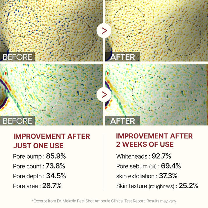 Dr.Melaxin Peel Shot Glow Set – Turmeric Spray & Rice Ampoule Duo